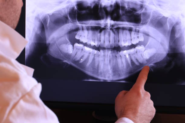 Best Emergency Dental Care for Broken or Chipped Teeth in Badin, NC