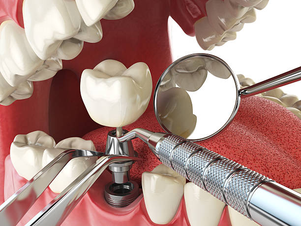 Best Same-Day Emergency Dental Services in Badin, NC